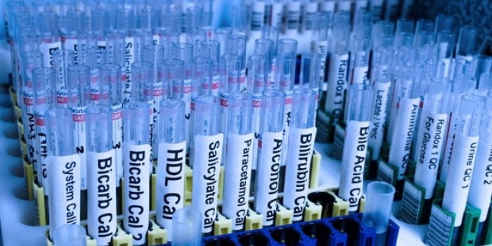 articolo dell'Avv. Salvatore Frattallone su legittimità dei test medici pre-assunzione.